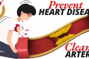 7 Superfoods That Cleanse Your Arteries and Prevent Heart Disease