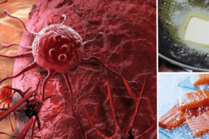 Everyday Cancer-Causing Foods? Oncologists Reveal the Top 10 You Should Know About