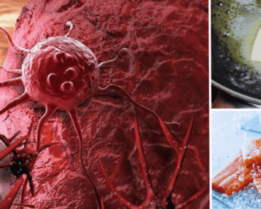 Everyday Cancer-Causing Foods? Oncologists Reveal the Top 10 You Should Know About