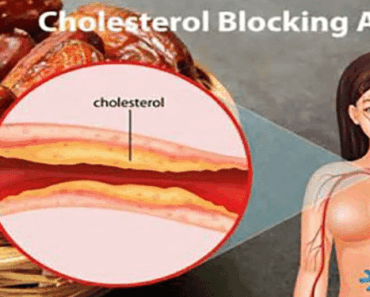 Is This the World’s #1 Food for Beating Strokes, High Blood Pressure, and Cholesterol?