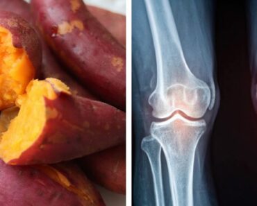 20 Natural Foods That Reduce Inflammation and Protect Joints 20 Natural Foods That Reduce Inflammation and Protect Joints